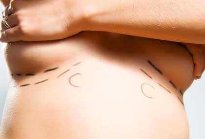 Brustchirurgie Chemnitz